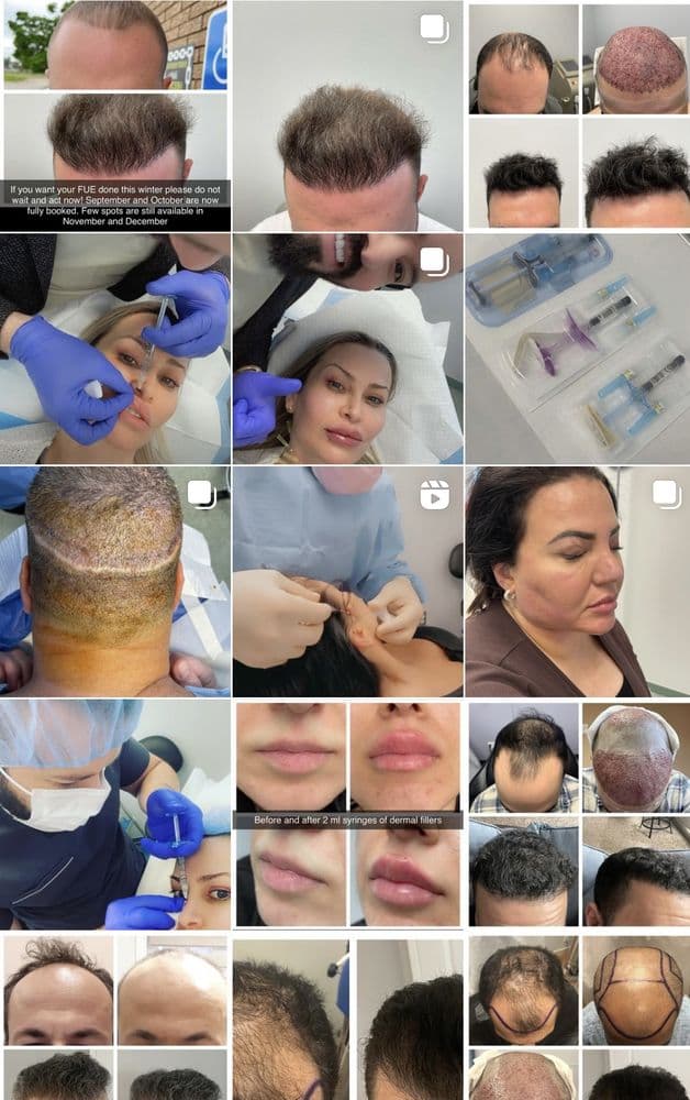 SB Clinic & Spa - hair transplant in Sterling Heights, MI