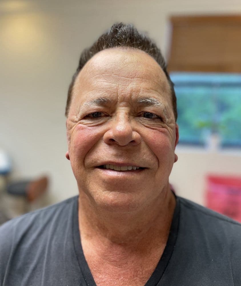 Aesthetics Medical Institute - hair transplant in Fort Lauderdale , FL