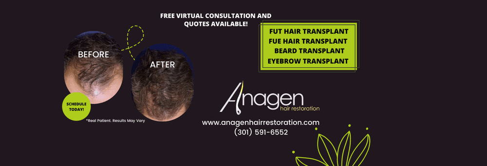 Anagen Hair Restoration - hair transplant in Silver Spring, MD