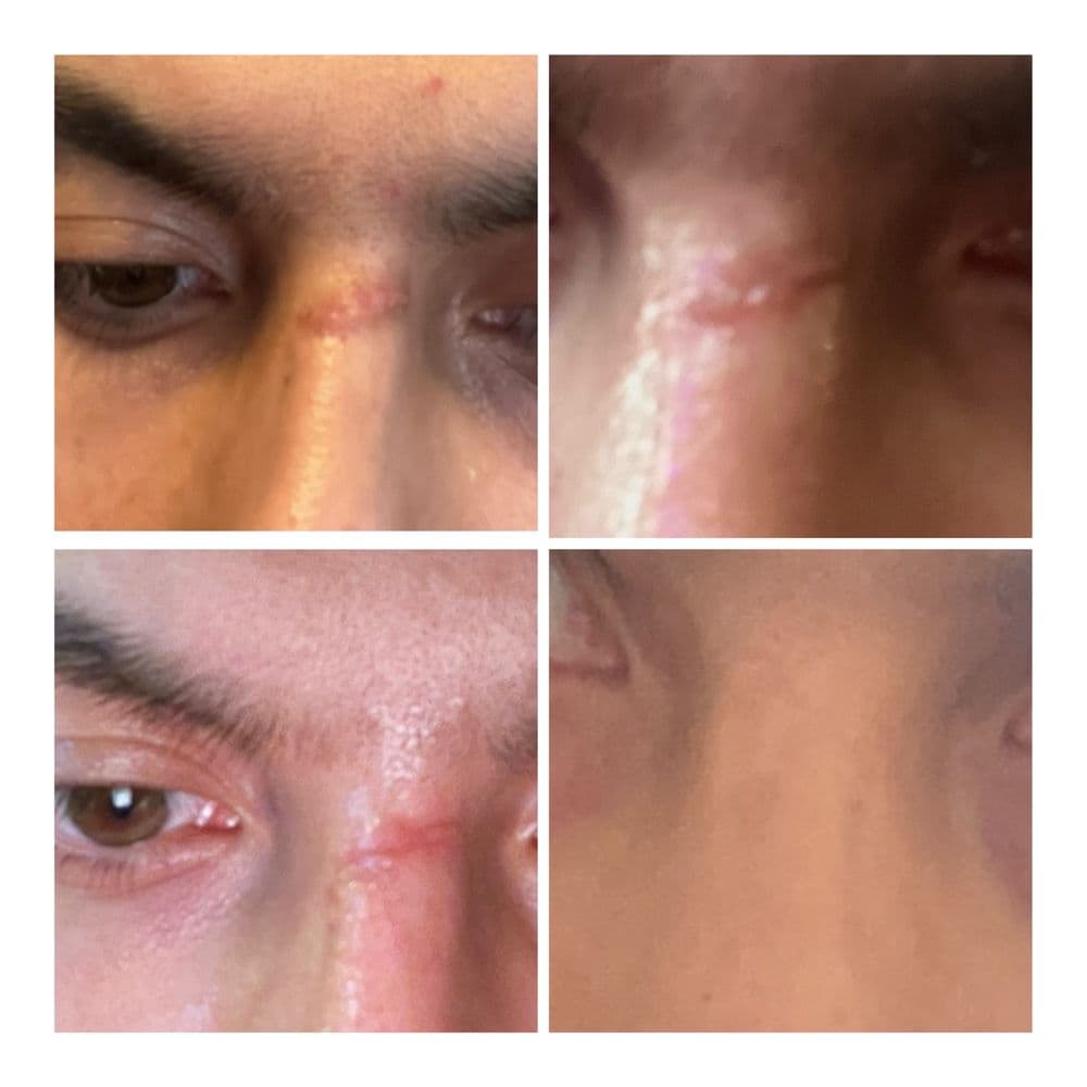 Advanced Dermatology and Laser Institute of Seattle - hair transplant in Seattle, WA