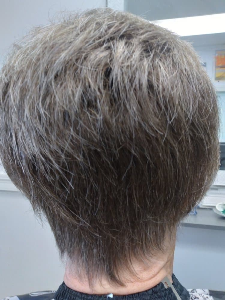 The WizarrD - hair transplant in Worcester, MA